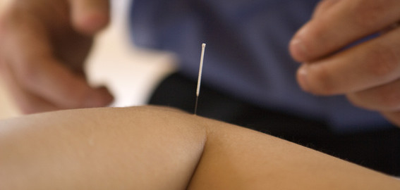 acupuncture for chronic pain, what is chronic pain, living with chronic pain