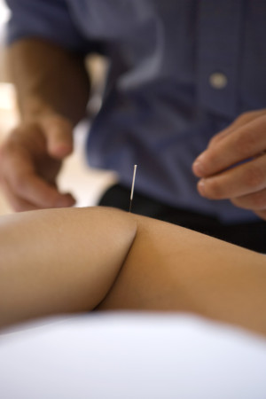 acupuncture for chronic pain, what is chronic pain, living with chronic pain